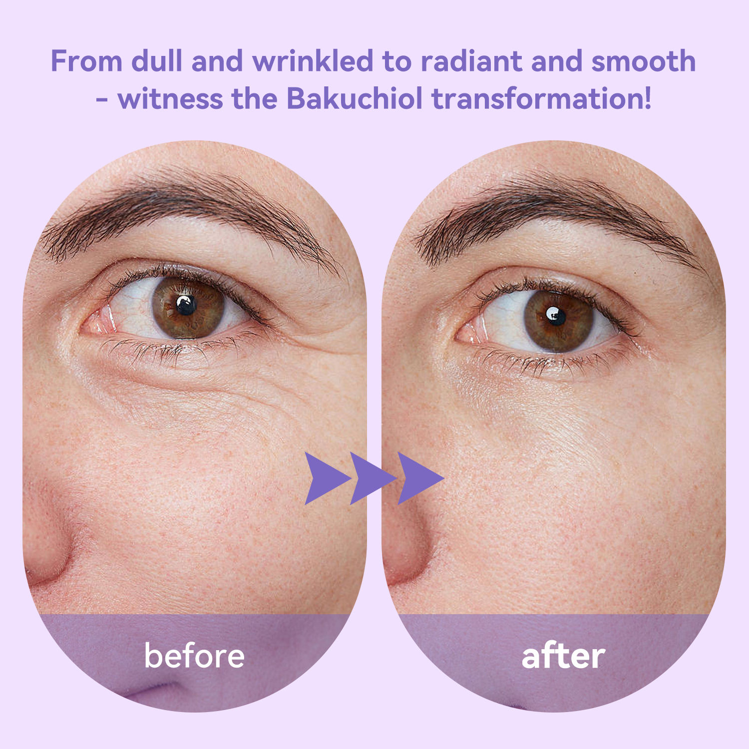 private label smooth fine lines & wrinkles bakuchiol skincare set